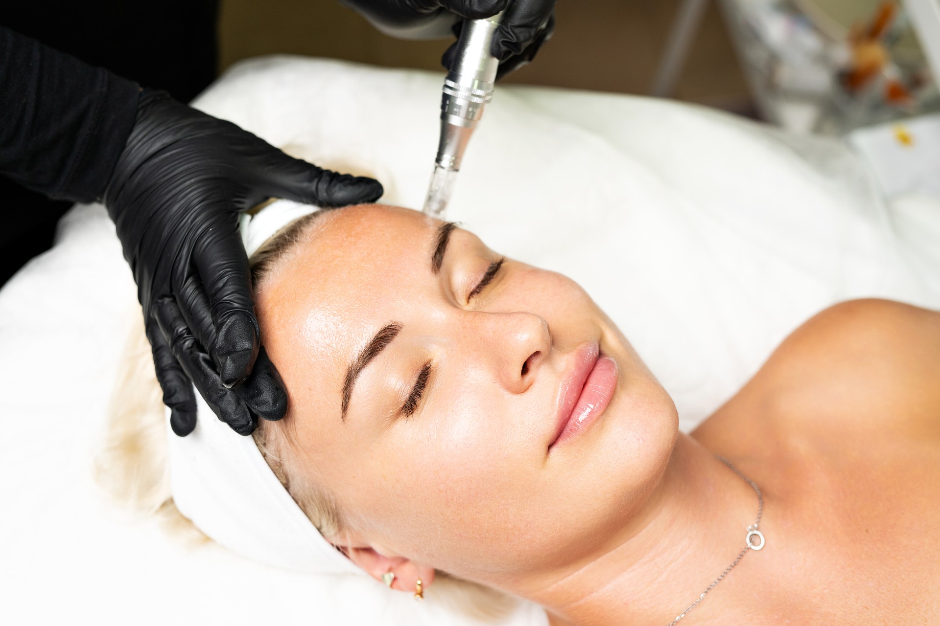 Microneedle RF lifting procedure. A cosmetologist performs a facial rejuvenation procedure on a woman. Hardware cosmetology.